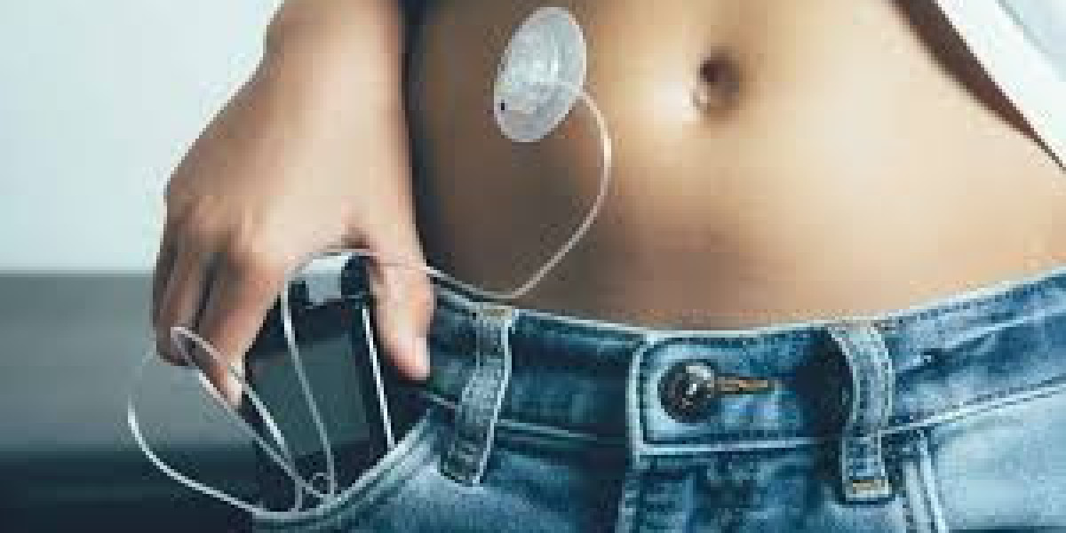 Insulin Pump Market Analysis Size And Forecast Report 2024-2032