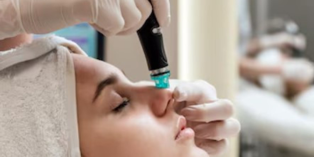 RF Microneedling: The Game-Changer in Skin Rejuvenation